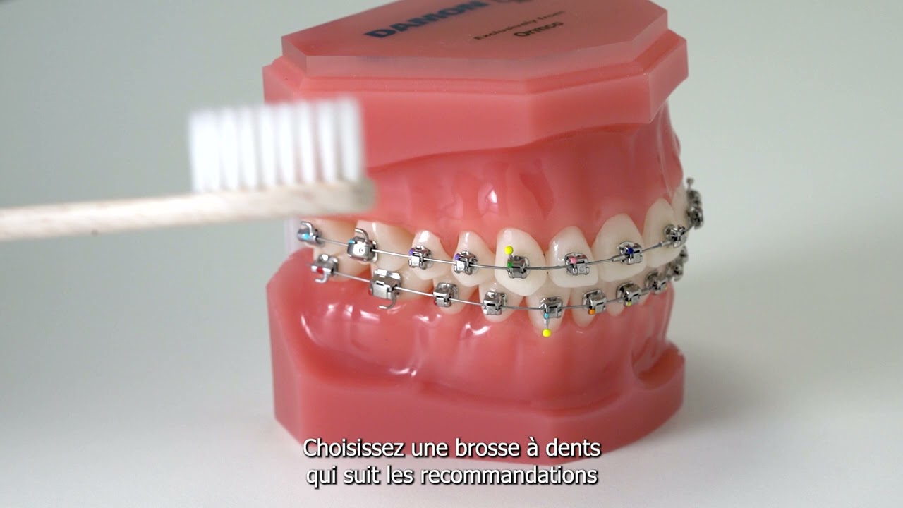 🦷 Comment bien se brosser les dents ? La bonne technique pour une bouche saine