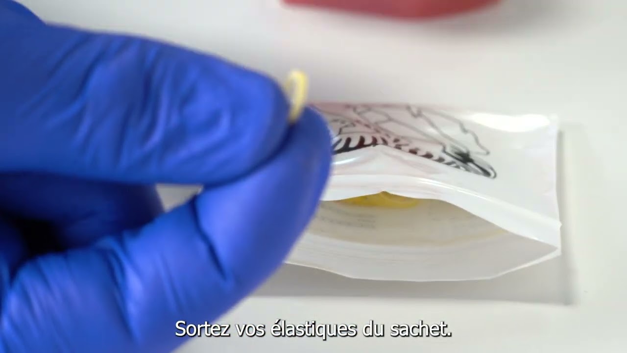 Comment poser des élastiques de Classe III en orthodontie | Technique avec multi-attaches (brackets)