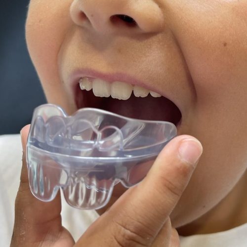 appareil interceptif