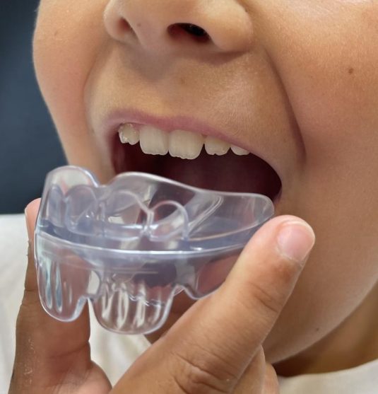 appareil interceptif